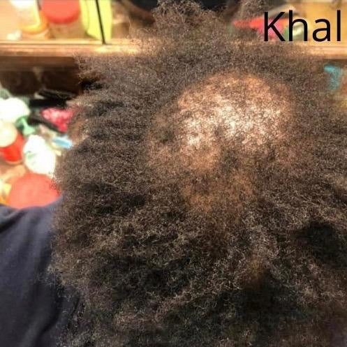 Original Kinky Hair Growth Oil